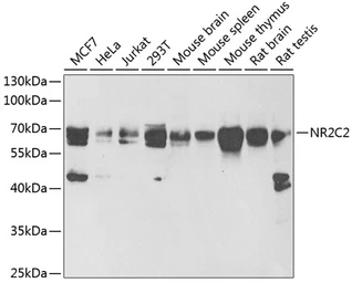 Anti-NR2C2 antibody used in Western Blot (WB). GTX54615