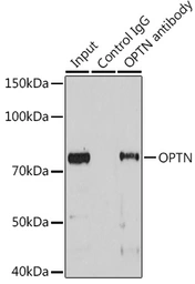 Anti-Optineurin antibody used in Immunoprecipitation (IP). GTX54617