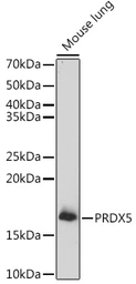 Anti-Peroxiredoxin 5 antibody used in Western Blot (WB). GTX54632