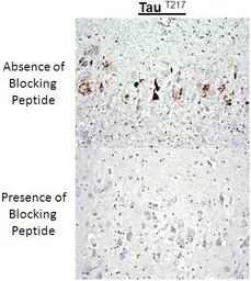 Anti-Tau (phospho Thr217) antibody used in Immunohistochemistry (IHC). GTX54655