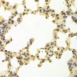 Anti-RanGAP1 antibody used in IHC (Paraffin sections) (IHC-P). GTX54667