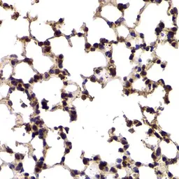 Anti-Splicing factor 1 antibody used in IHC (Paraffin sections) (IHC-P). GTX54670