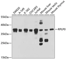 Anti-RPLP0 antibody used in Western Blot (WB). GTX54687