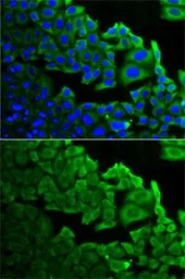 Anti-RPLP0 antibody used in Immunocytochemistry/ Immunofluorescence (ICC/IF). GTX54687