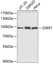 Anti-SSRP1 antibody used in Western Blot (WB). GTX54690