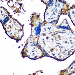 Anti-CD62E antibody used in IHC (Paraffin sections) (IHC-P). GTX54691
