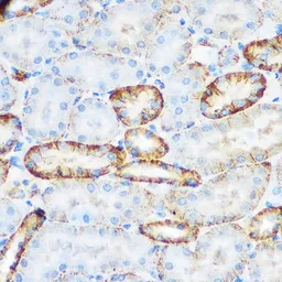 Anti-CD62E antibody used in IHC (Paraffin sections) (IHC-P). GTX54691