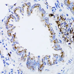 Anti-Retinoic Acid Receptor alpha antibody used in IHC (Paraffin sections) (IHC-P). GTX54703