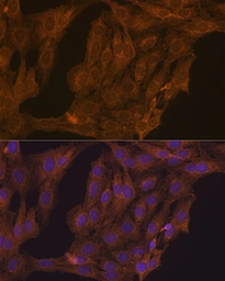 Anti-Retinoic Acid Receptor alpha antibody used in Immunocytochemistry/ Immunofluorescence (ICC/IF). GTX54703