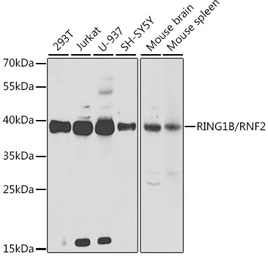Anti-RNF2 antibody used in Western Blot (WB). GTX54707