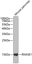 Anti-Ribonuclease A antibody used in Western Blot (WB). GTX54711