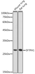 Anti-Surfactant Protein A antibody used in Western Blot (WB). GTX54714