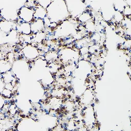 Anti-Surfactant Protein A antibody used in IHC (Paraffin sections) (IHC-P). GTX54714