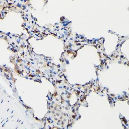 Anti-Surfactant Protein A antibody used in IHC (Paraffin sections) (IHC-P). GTX54714