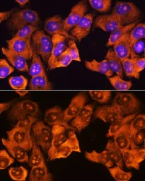 Anti-RPS3 antibody used in Immunocytochemistry/ Immunofluorescence (ICC/IF). GTX54720