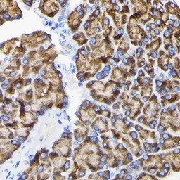 Anti-RPS3 antibody used in IHC (Paraffin sections) (IHC-P). GTX54720