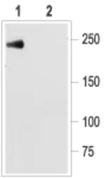 Anti-Nav1.5 antibody used in Western Blot (WB). GTX54803