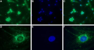 Anti-Cav3.2 antibody used in Immunocytochemistry/ Immunofluorescence (ICC/IF). GTX54813
