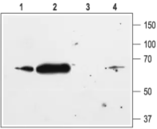 Anti-Kir2.1 antibody used in Western Blot (WB). GTX54830