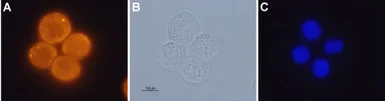 Anti-Orexin Receptor 1 antibody used in Immunocytochemistry/ Immunofluorescence (ICC/IF). GTX54847