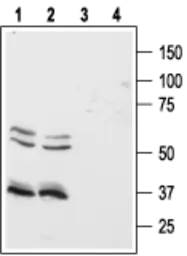 Anti-Orexin Receptor 1 antibody used in Western Blot (WB). GTX54847