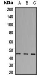 Anti-ABHD3 antibody used in Western Blot (WB). GTX54881