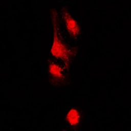 Anti-AKAP13 antibody used in Immunocytochemistry/ Immunofluorescence (ICC/IF). GTX54888