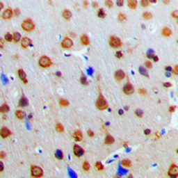 Anti-AKAP13 antibody used in IHC (Paraffin sections) (IHC-P). GTX54888