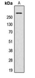 Anti-AKAP13 antibody used in Western Blot (WB). GTX54888