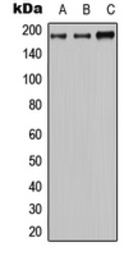 Anti-MRP2 antibody used in Western Blot (WB). GTX54899