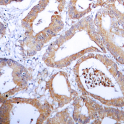 Anti-AKR1B1 antibody used in IHC (Paraffin sections) (IHC-P). GTX54911