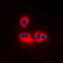 Anti-ACOT2 antibody used in Immunocytochemistry/ Immunofluorescence (ICC/IF). GTX54912