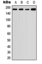 Anti-alpha 2 Macroglobulin antibody used in Western Blot (WB). GTX54918