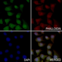 Anti-Acetyl-CoA Carboxylase 1 antibody used in Immunocytochemistry/ Immunofluorescence (ICC/IF). GTX54946