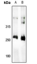 Anti-Acetyl-CoA Carboxylase 1 antibody used in Western Blot (WB). GTX54946