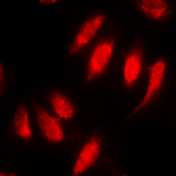 Anti-SMAD2 (phospho Ser467) antibody used in Immunocytochemistry/ Immunofluorescence (ICC/IF). GTX54987