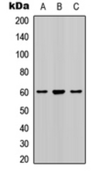 Anti-SMAD2 (phospho Ser467) antibody used in Western Blot (WB). GTX54987