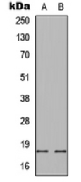 Anti-alpha Synuclein (phospho Ser129) antibody used in Western Blot (WB). GTX54991
