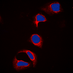 Anti-CBL (phospho Tyr700) antibody used in Immunocytochemistry/ Immunofluorescence (ICC/IF). GTX55004