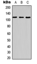 Anti-CBL (phospho Tyr700) antibody used in Western Blot (WB). GTX55004