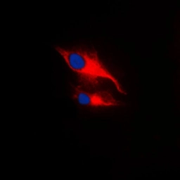Anti-Lck (phospho Tyr394) antibody used in Immunocytochemistry/ Immunofluorescence (ICC/IF). GTX55100
