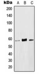Anti-Lck (phospho Tyr394) antibody used in Western Blot (WB). GTX55100