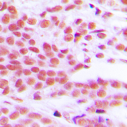 Anti-NFkB p65 (phospho Ser529) antibody used in IHC (Paraffin sections) (IHC-P). GTX55127