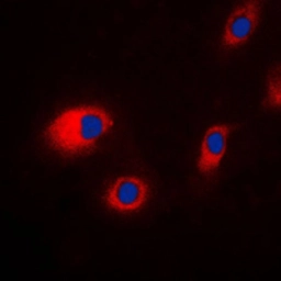 Anti-CLCN7 antibody used in Immunocytochemistry/ Immunofluorescence (ICC/IF). GTX55139