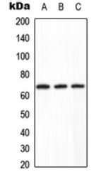 Anti-PPP2R1B antibody used in Western Blot (WB). GTX55165