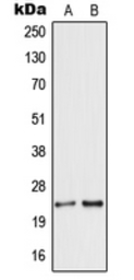 Anti-Secretogranin V antibody used in Western Blot (WB). GTX55171