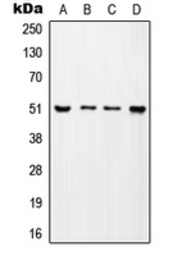 Anti-ADA2a antibody used in Western Blot (WB). GTX55173