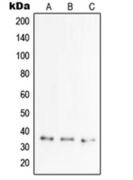 Anti-TSG6 antibody used in Western Blot (WB). GTX55175