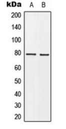 Anti-BARD1 antibody used in Western Blot (WB). GTX55221