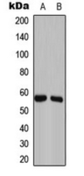 Anti-GAS8 antibody used in Western Blot (WB). GTX55223